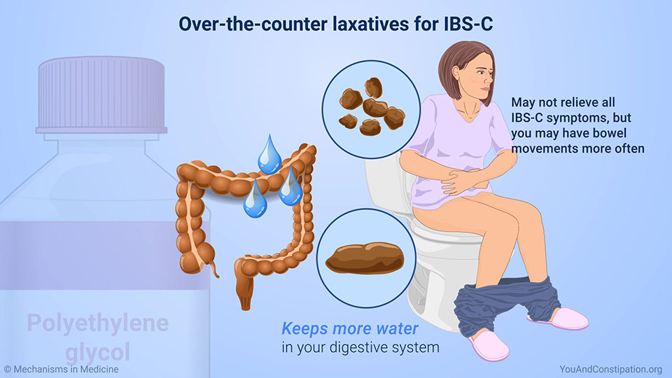 Over-the-counter laxatives for IBS-C