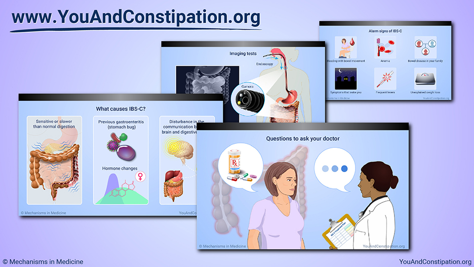 Diagnosing IBS with Constipation
