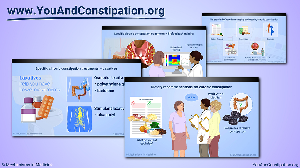 Slide Show - Managing and Treating Chronic Constipation