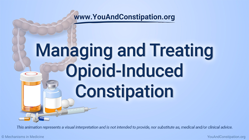 Managing and Treating Opioid-Induced Constipation