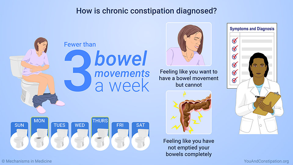 How is chronic constipation diagnosed?