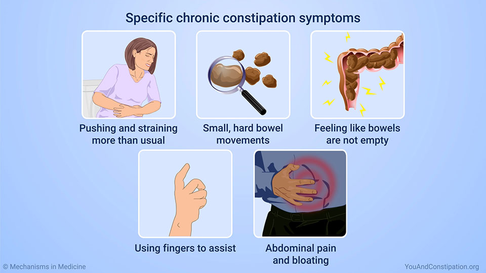 Specific chronic constipation symptoms 