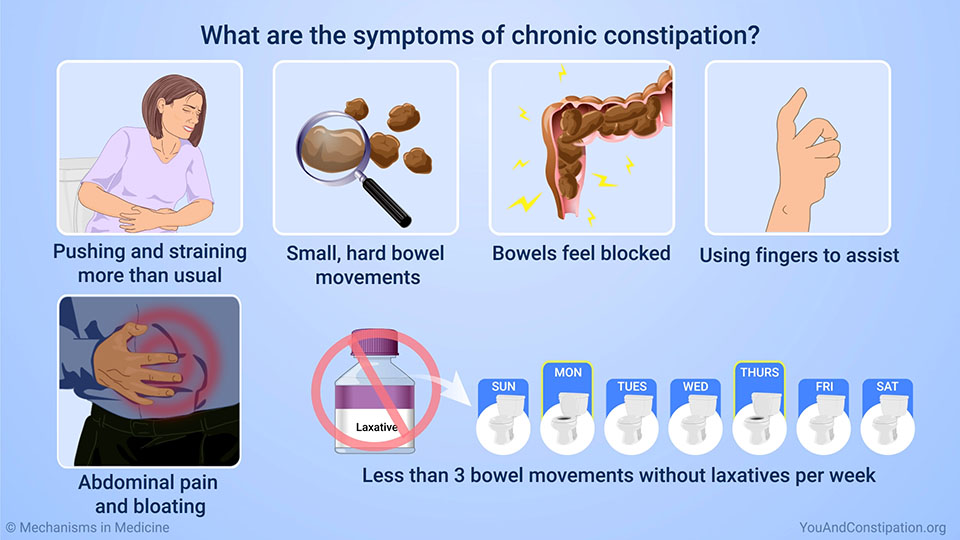 What are the Consequences of Chronic Constipation