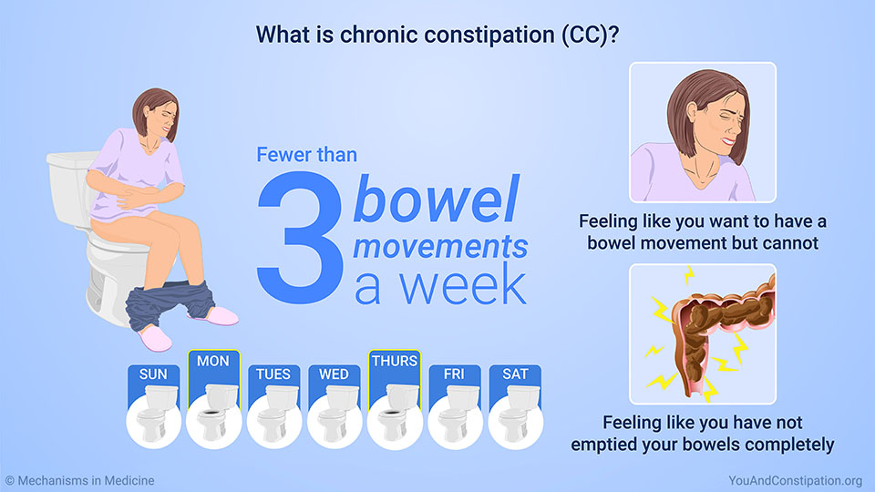What is chronic constipation (CC)?