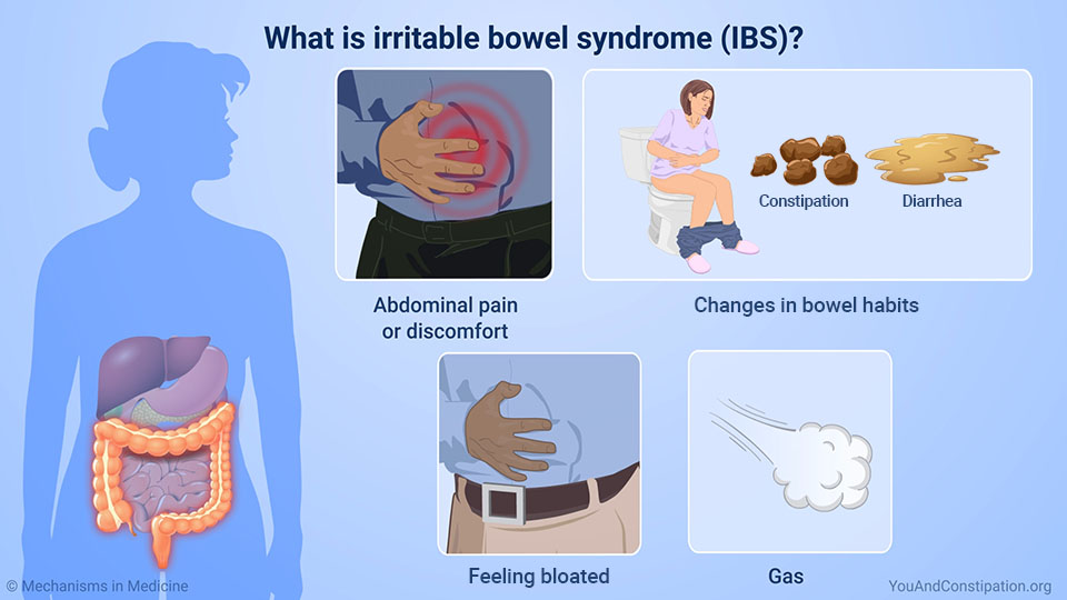 change bowel habits icd 10