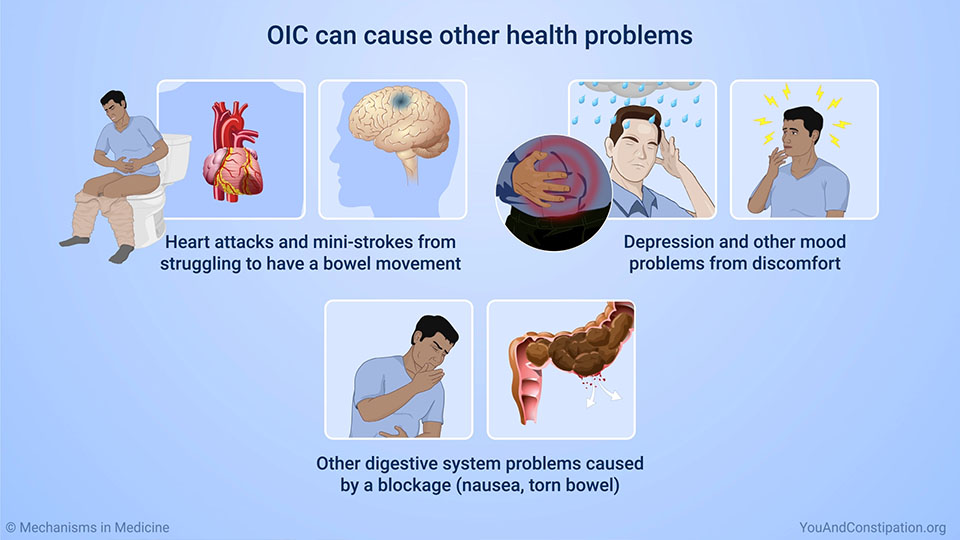 OIC can cause other health problems 